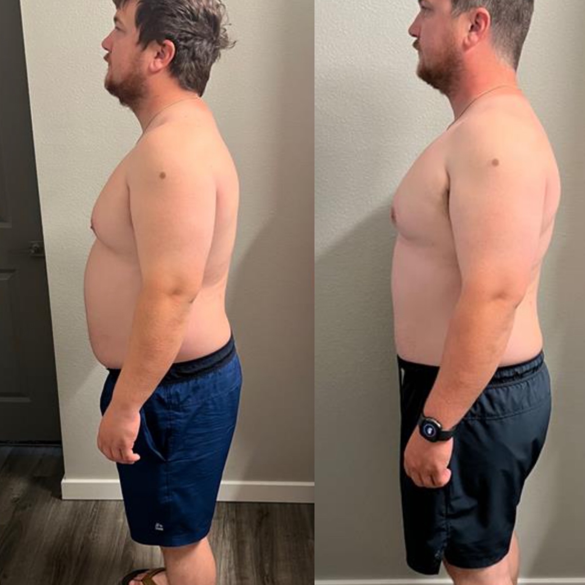 Before and after transformation of an iAMLIFT personal training client in League City, TX (2)